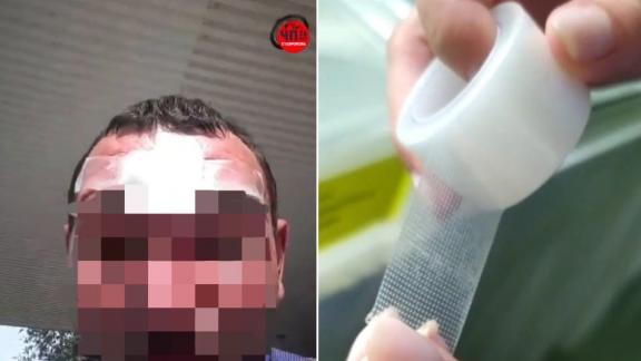 В больнице Арзгирского округа на Ставрополье развенчали миф об использовании скотча