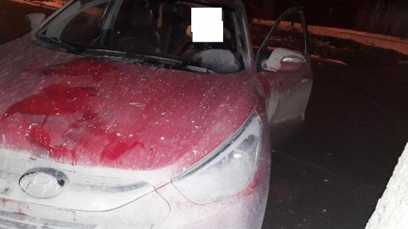 В Ессентуках иномарка сбила 24-летнюю девушку