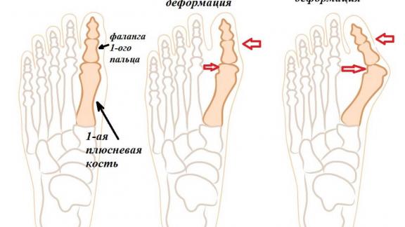 В Железноводске будут оказывать ещё один вид травматологической помощи