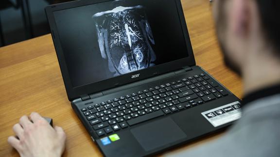 Новый способ распознавания рака кожи открыли учёные СКФУ