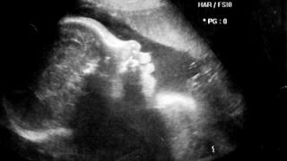 Медучреждения Железноводска получили современные УЗИ-аппараты