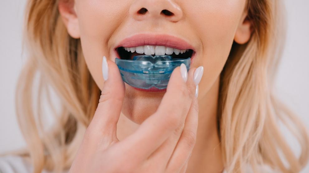 Трейнеры: как избавится от ряда ортодонтических проблем удобно и доступно