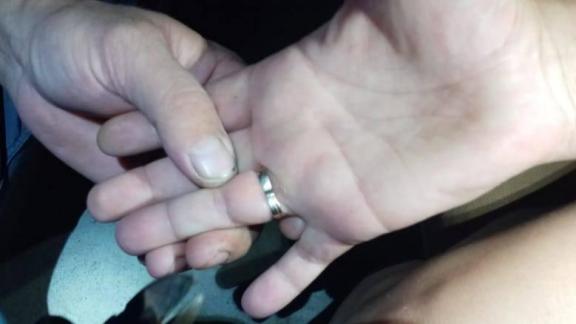 Спасатели помогли снять кольцо женщине в Красногвардейском округе Ставрополья