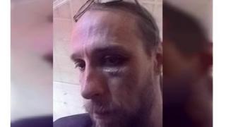 На ставропольского журналиста Антона Чаблина напали двое