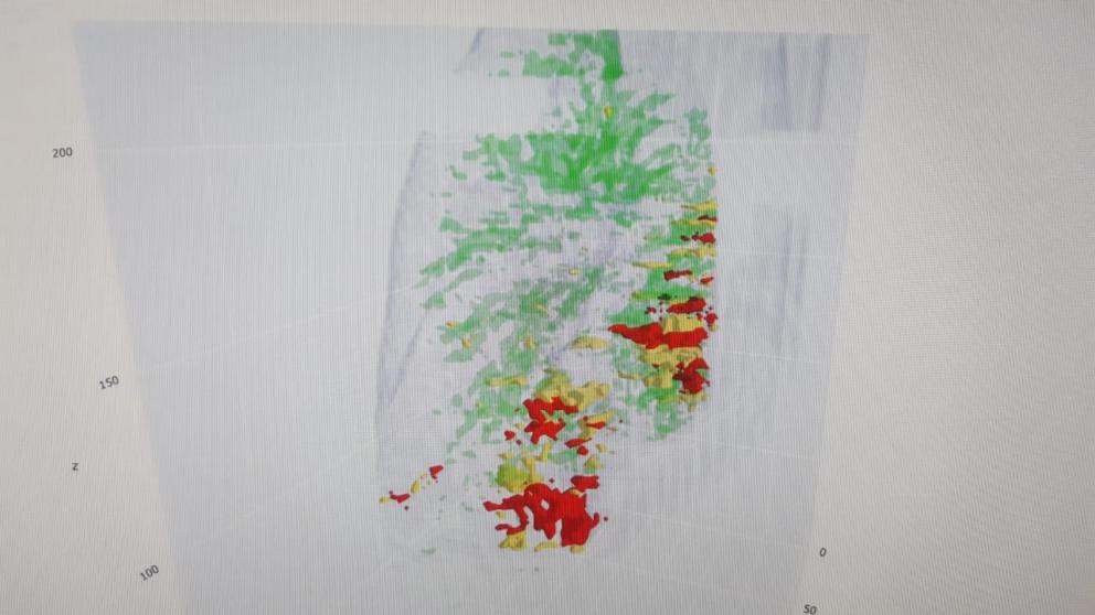 Ставропольские медики используют новый способ диагностики лёгких